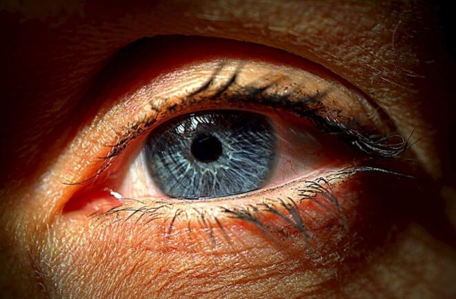 早期晶状体脱位所致青光眼有哪些症状